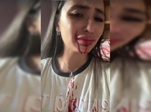 video:-em-surto,-mae-joga-facao-no-rosto-de-ex-dancarina-do-faustao