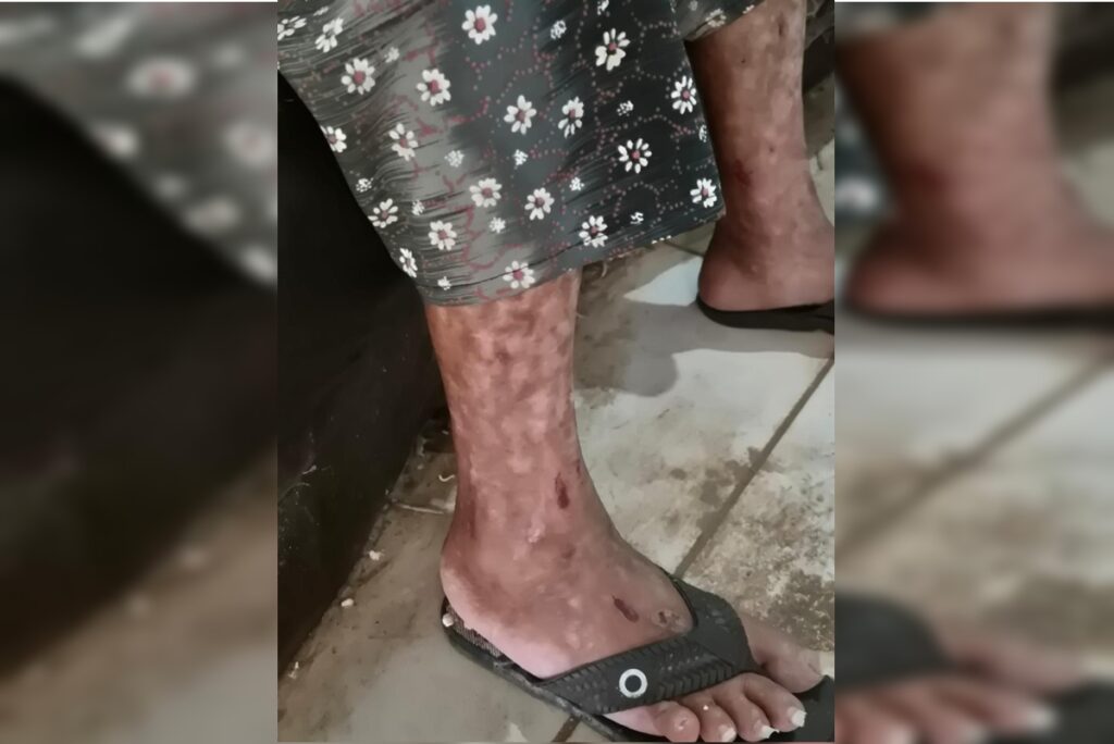 testemunha-ouviu-filho-que-manteve-mae-presa-gritar:-“morre,-velha”