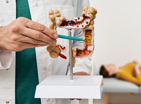 grao-popular-ajuda-a-regular-o-intestino-e-apoia-a-saude-dos-rins