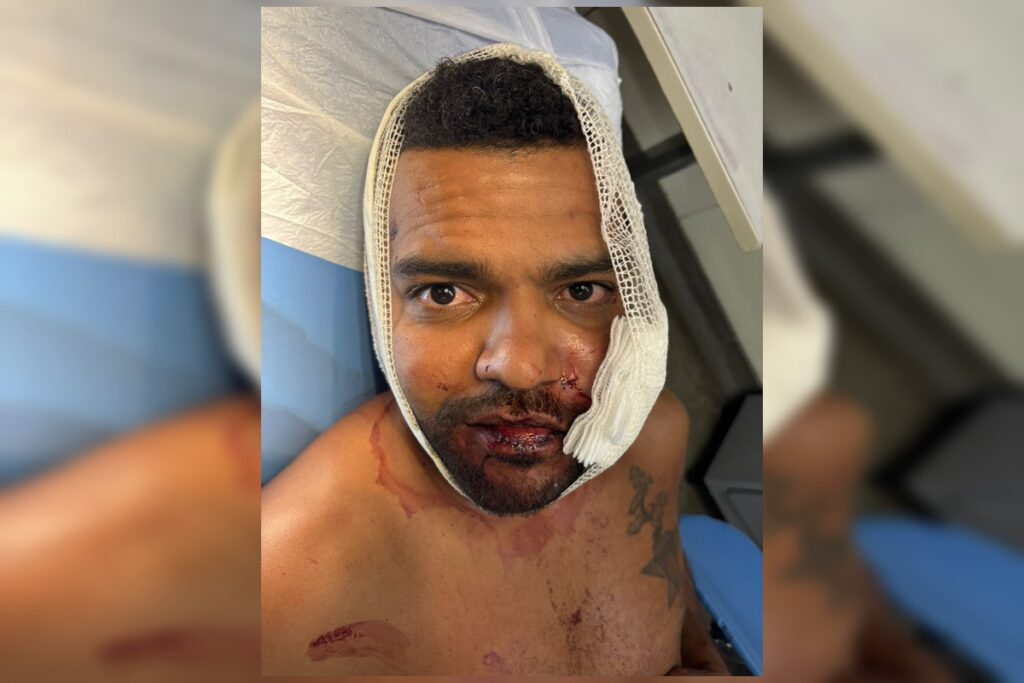 “achei-que-ia-morrer”,-diz-jovem-que-teve-rosto-rasgado-por-advogado