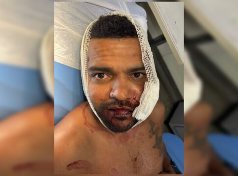 “achei-que-ia-morrer”,-diz-jovem-que-teve-rosto-rasgado-por-advogado