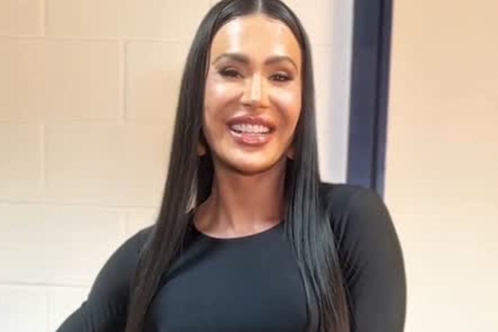 foto:-gracyanne-barbosa-choca-ao-mostrar-cicatriz-no-joelho