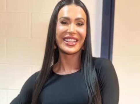 foto:-gracyanne-barbosa-choca-ao-mostrar-cicatriz-no-joelho