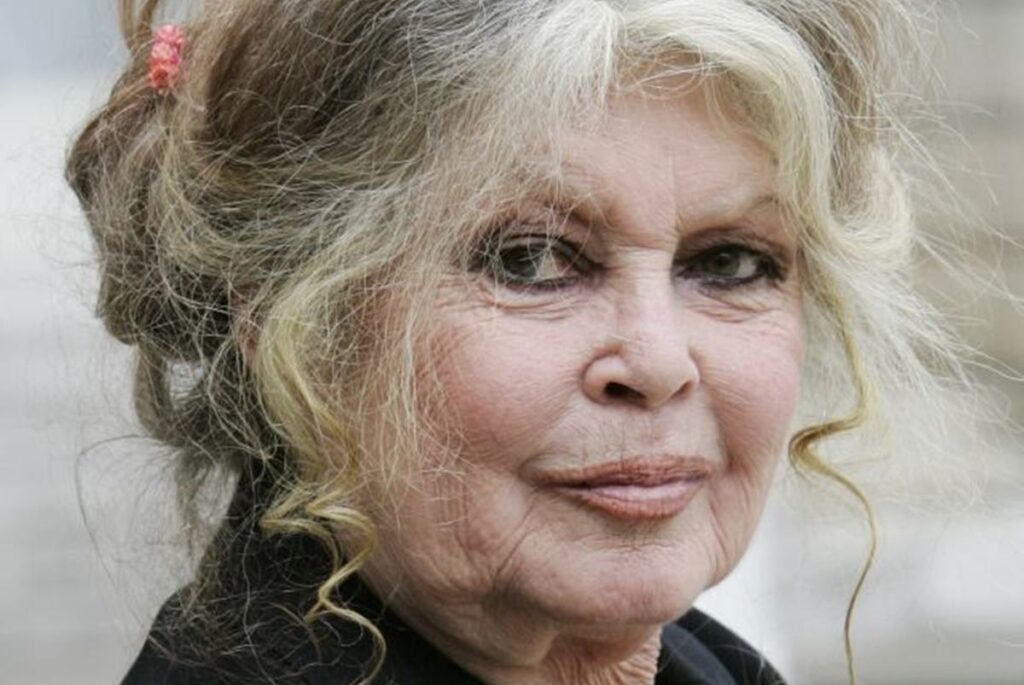 aos-91-anos,-brigitte-bardot-e-internada-em-estado-grave