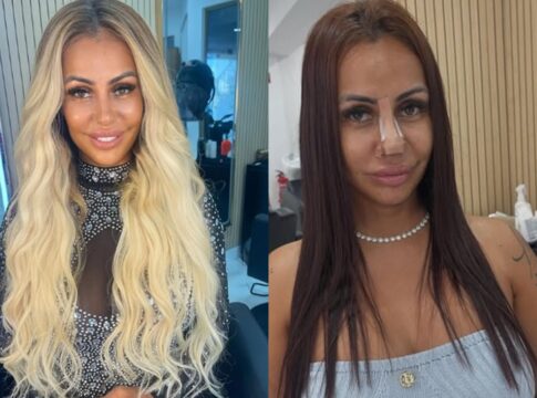 influencer-revela-que-refez-harmonizacao-facial-apos-dica-do-chatgpt