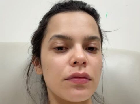 ex-bbb-e-internada-apos-sofrer-inflamacao-provocada-por-contraceptivo