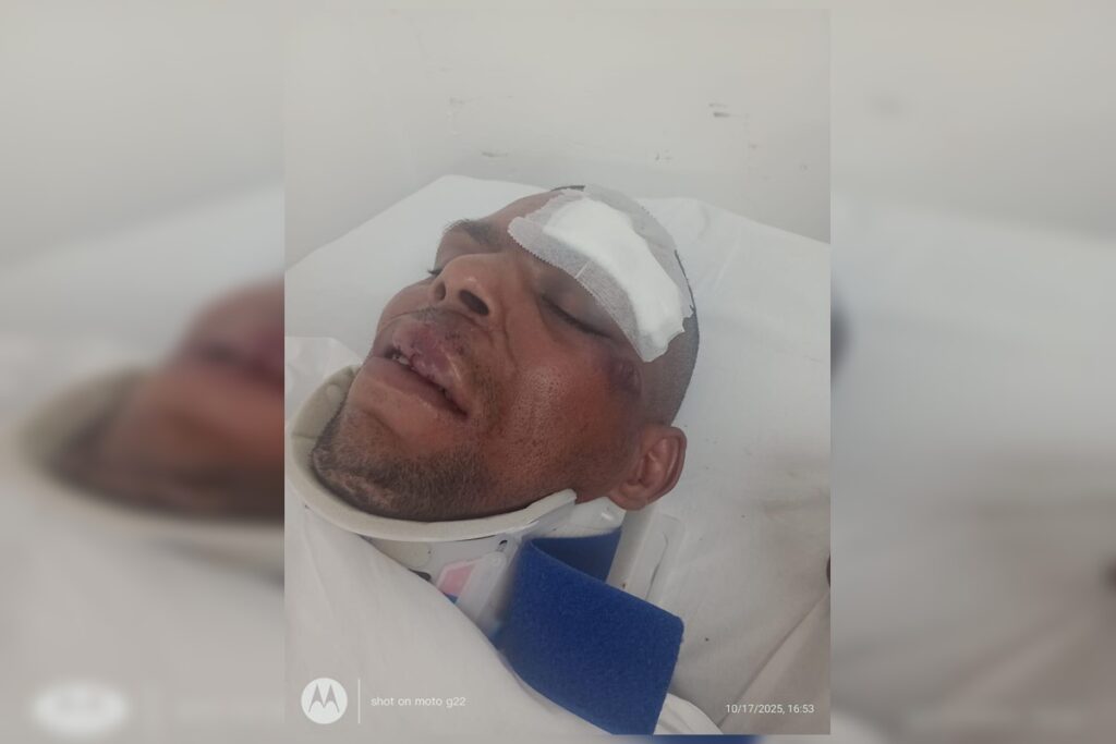 video:-ciclista-quase-perde-o-braco-ao-ser-atropelado-por-onibus-no-df