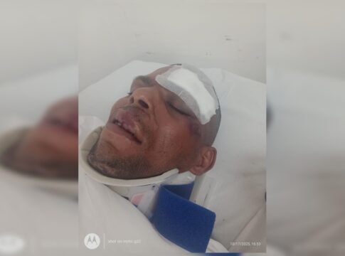 video:-ciclista-quase-perde-o-braco-ao-ser-atropelado-por-onibus-no-df