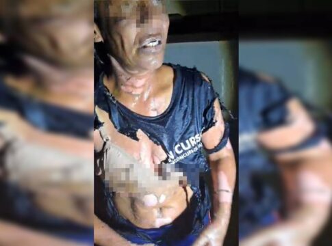 mulher-e-vitima-de-tentativa-de-feminicidio:-“ele-tacou-fogo-em-mim”