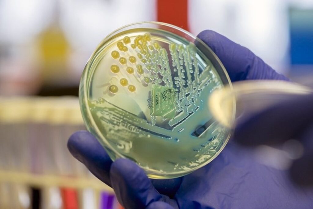 saiba-qual-e-a-superbacteria-se-espalhou-pelo-hospital-da-crianca