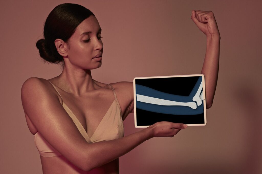 alem-do-leite:-o-que-comer-e-beber-para-prevenir-a-osteoporose