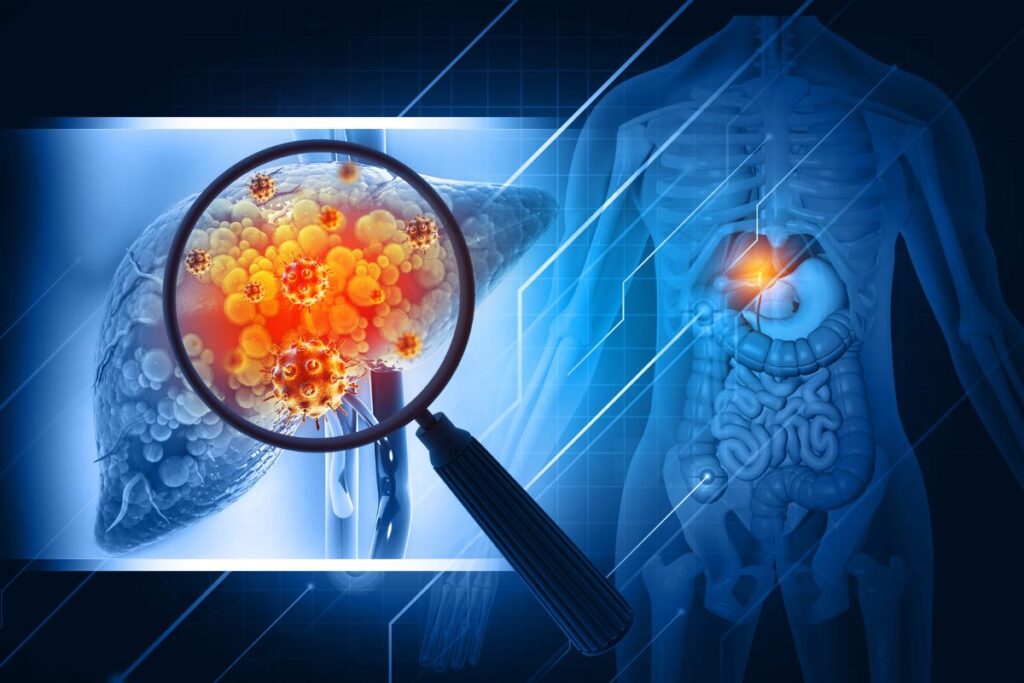 fibrose-hepatica:-como-reverter-quadro-grave-no-figado,-segundo-medica