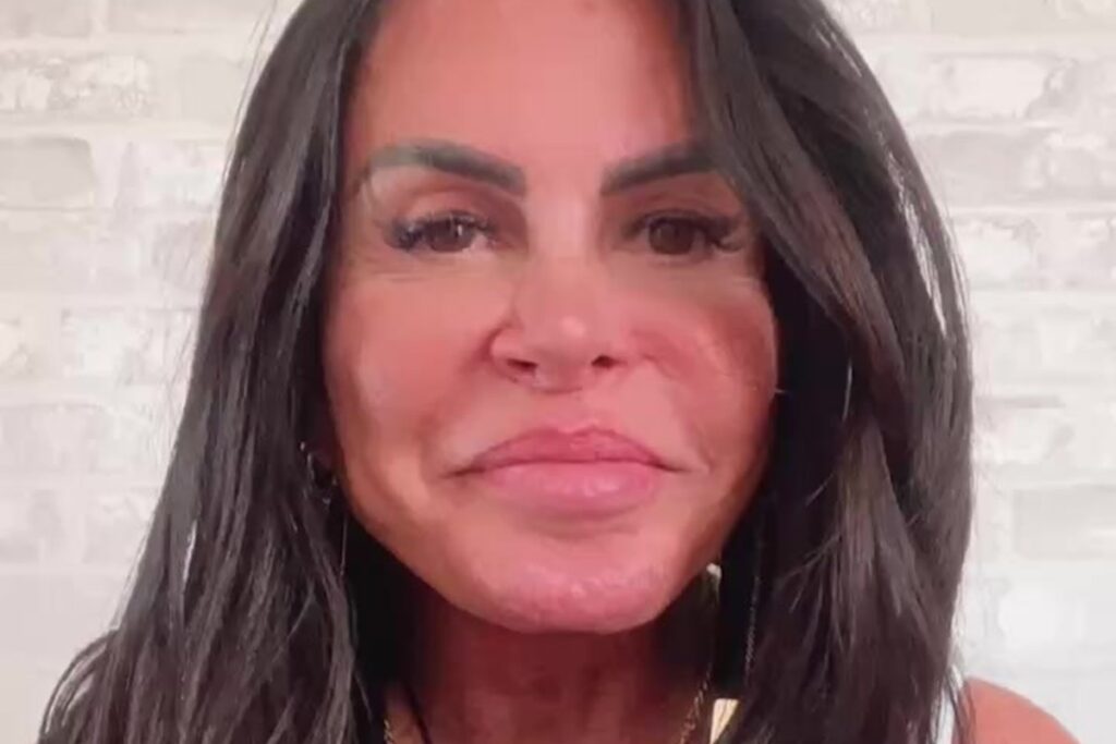 gretchen-desabafa-sobre-luta-contra-alopecia:-“nao-tenho-mais-cabelo”