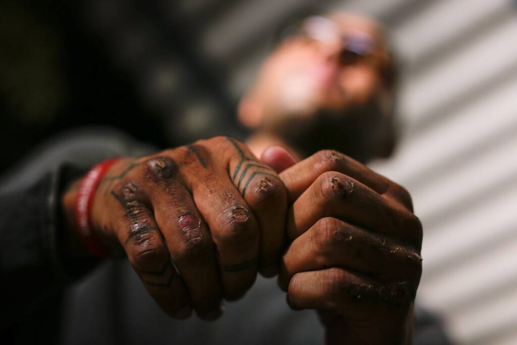 mpdft-denuncia-14-policiais-militares-por-tortura-de-soldado-em-curso