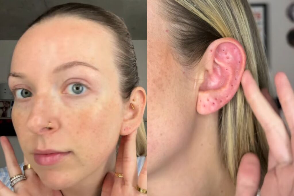 mulher-retira-41-piercings-e-e-criticada-apos-exibir-furos-na-orelha