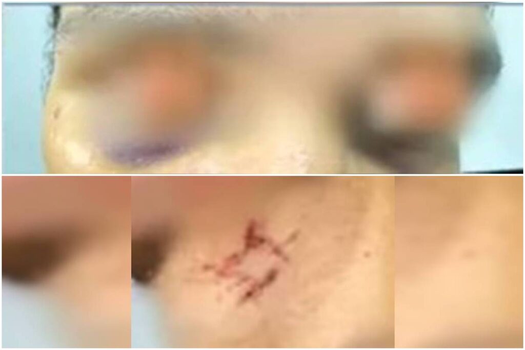 “sexo-por-drogas”:-criminoso-diz-que-prendeu-vitima-apos-se-apaixonar