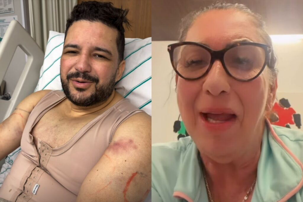 padrasto-de-virginia-faz-lipo-“as-escondidas”-e-surpreende-margareth