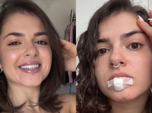 miss-bumbum-relata-acidente-com-piercing-durante-relacao-intima