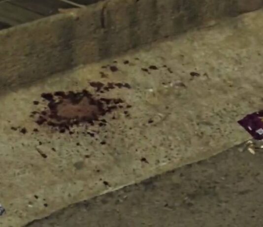 bebedeira-e-facada-na-jugular:-homem-acusa-amigo-de-furto-e-o-ataca