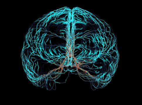falha-em-celulas-cerebrais-pode-favorecer-demencia,-diz-estudo