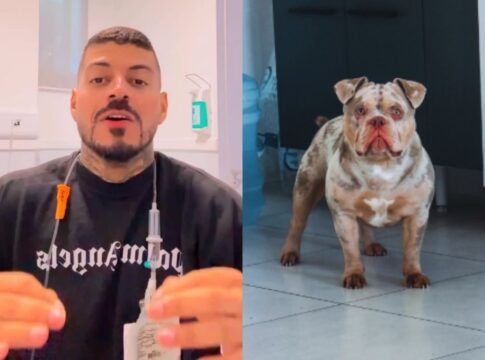 influenciador-acorda-sem-dedo-e-descobre-que-cachorro-comeu-o-membro