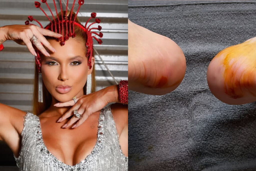 virginia-mostra-preparacao-para-o-carnaval-e-expoe-pes-machucados