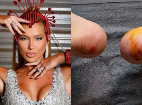 virginia-mostra-preparacao-para-o-carnaval-e-expoe-pes-machucados