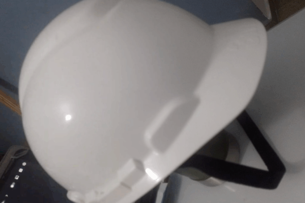 homem-fica-ferido-ao-ser-atacado-por-gaviao:-“tem-que-usar-capacete”