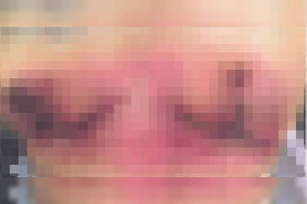 mulher-que-teve-seios-necrosados-denuncia-medico-do-df-por-erro