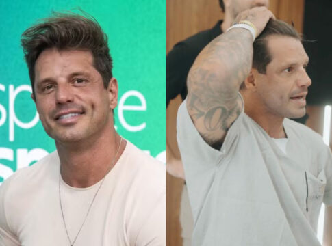 fotos:-fernando-fernandes-passa-por-transplante-capilar