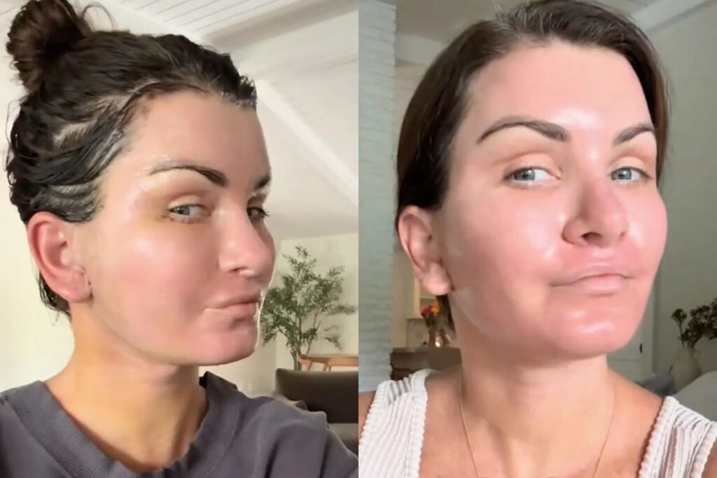 mulher-gasta-r$-410-mil-em-cirurgias-e-se-pergunta:-“que-diabos-eu-fiz?”