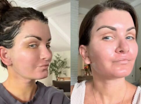 mulher-gasta-r$-410-mil-em-cirurgias-e-se-pergunta:-“que-diabos-eu-fiz?”