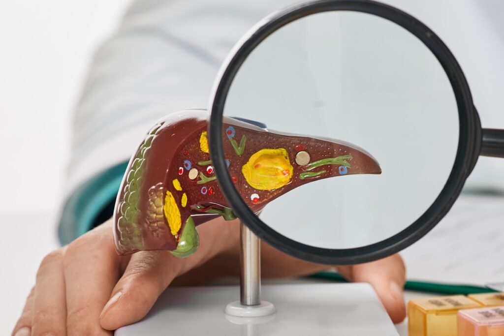 entenda-a-relacao-entre-a-proteina-e-o-acumulo-de-gordura-no-figado