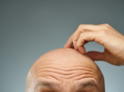 eles-tambem-merecem:-saiba-como-cuidar-da-pele-da-cabeca-dos-carecas