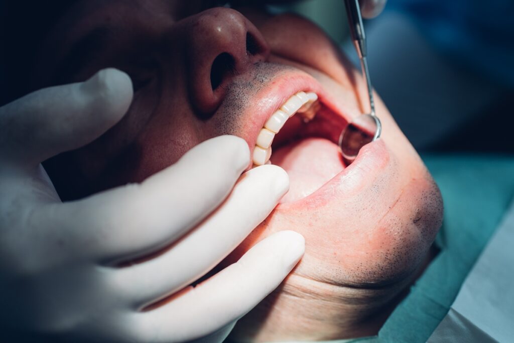 doencas-gengivais-e-caries-podem-aumentar-risco-de-avc,-aponta-estudo