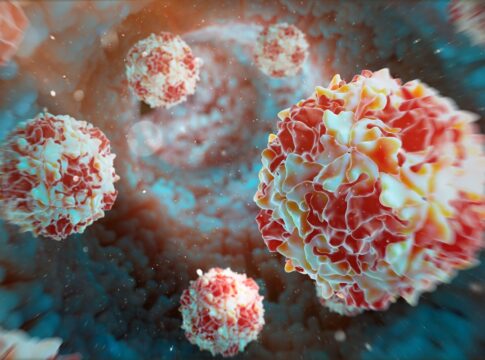 alemanha-encontra-virus-selvagem-da-poliomielite-em-aguas-residuais