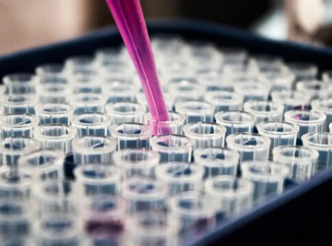 estudo-mostra-que-inflamacao-no-cerebro-pode-ser-chave-do-alzheimer