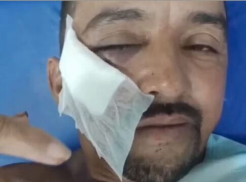 tijolada-no-rosto:-gari-e-agredido-por-morador-apos-briga-sobre-lixo