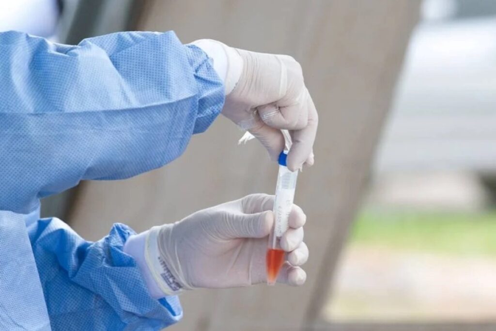 saude-poe-em-sigilo-valor-da-compra-de-73-milhoes-de-testes-de-covid