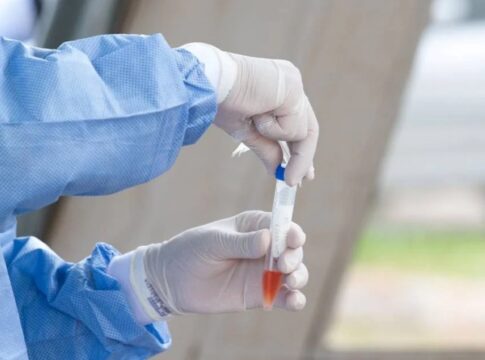 saude-poe-em-sigilo-valor-da-compra-de-73-milhoes-de-testes-de-covid