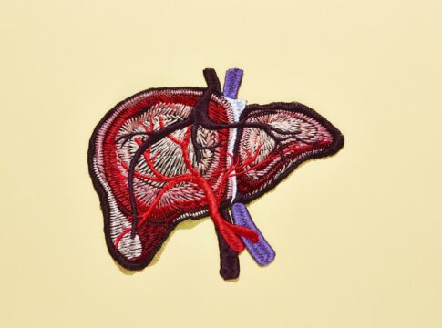 gordura-no-figado-tem-sintomas?-conheca-sinais-associados-a-condicao