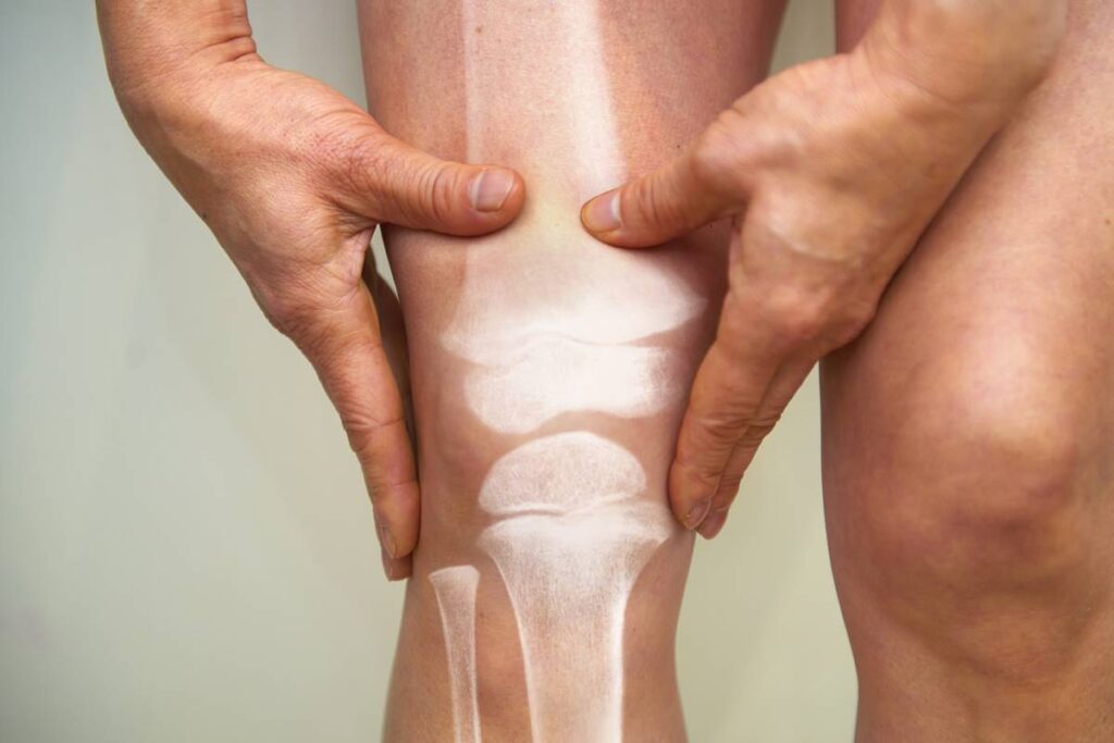 as-melhores-⁠posicoes-sexuais-para-quem-sofre-de-dor-nas-articulacoes