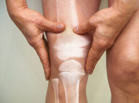 as-melhores-⁠posicoes-sexuais-para-quem-sofre-de-dor-nas-articulacoes