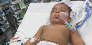 bebe-perde-metade-da-lingua-apos-confundir-soda-caustica-com-leite