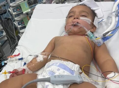 bebe-perde-metade-da-lingua-apos-confundir-soda-caustica-com-leite