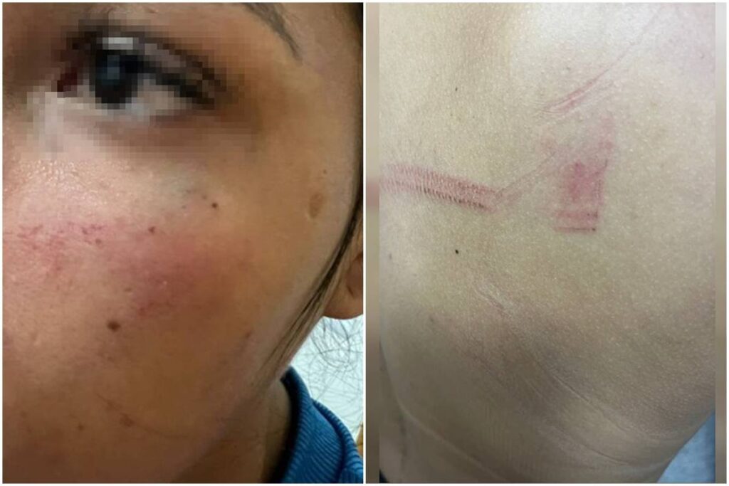 socos,-chutes-e-ameaca-da-morte:-mulher-e-violentada-pelo-namorado