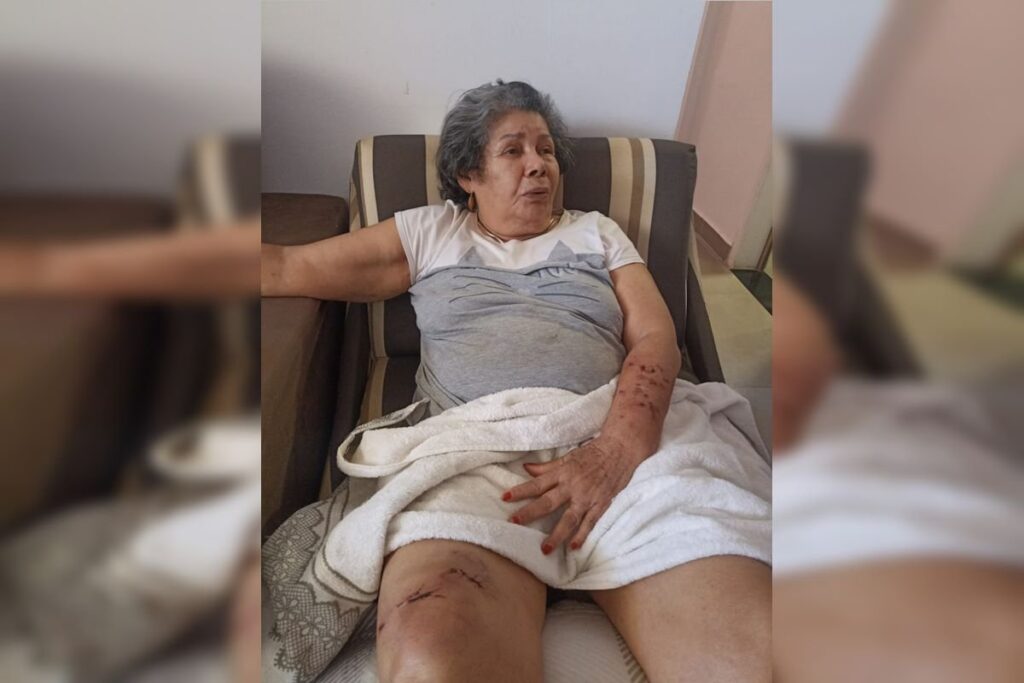 idosa-ferida-por-caes-soltos-na-rua-detalha-ataque:-“estavam-violentos”