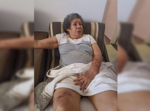 idosa-ferida-por-caes-soltos-na-rua-detalha-ataque:-“estavam-violentos”