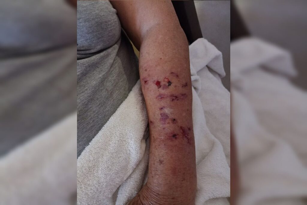 garrafada-e-chute-na-cabeca:-como-idosa-se-livrou-de-ataque-de-caes