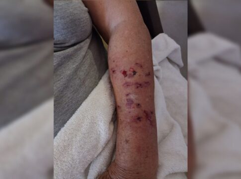 garrafada-e-chute-na-cabeca:-como-idosa-se-livrou-de-ataque-de-caes